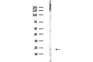 Western blot analysis of lysates from Hela cells(LPS 4h treatment), using TNF beta Antibody at 1/1000 dilution.
