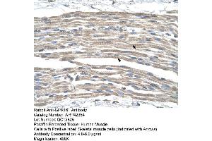 Rabbit Anti-GPR161 Antibody  Paraffin Embedded Tissue: Human Muscle Cellular Data: Skeletal muscle cells Antibody Concentration: 4. (GPR161 antibody  (Middle Region))