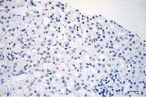 Immunohistochemistry was performed on paraffin-embedded mouse kidney using XPD antibody (ABIN7798540), 1:200).