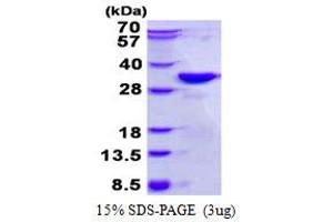 Image no. 1 for Dickkopf 2 Homolog (DKK2) protein (His tag) (ABIN1098672)