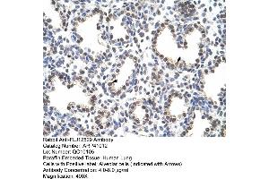 Rabbit Anti-FLJ12529 Antibody  Paraffin Embedded Tissue: Human Lung Cellular Data: Alveolar cells Antibody Concentration: 4. (CPSF7 antibody  (C-Term))