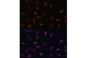 Immunofluorescence analysis of U-2 OS cells using LLPH antibody (ABIN7268290) at dilution of 1:100. (LLPH antibody  (AA 1-129))