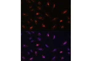 Immunofluorescence analysis of U-2 OS cells using LLPH antibody (ABIN7268290) at dilution of 1:100. (LLPH antibody  (AA 1-129))