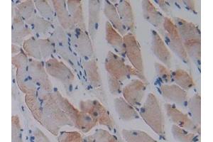 DAB staining on IHC-P; Samples: Mouse Skeletal muscle Tissue (CCL9 antibody  (AA 22-122))