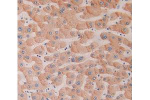 Used in DAB staining on fromalin fixed paraffin- embedded liver tissue (CD39 antibody  (AA 241-486))