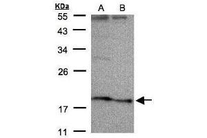 WB Image Sample(30 μg of whole cell lysate) A:HeLa S3, B:Hep G2, 12% SDS PAGE antibody diluted at 1:500 (SCN3B antibody  (Center))