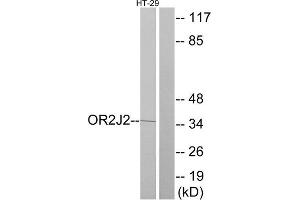 Western Blotting (WB) image for anti-Olfactory Receptor, Family 2, Subfamily J, Member 2 (OR2J2) (C-Term) antibody (ABIN1853218) (OR2J2 antibody  (C-Term))