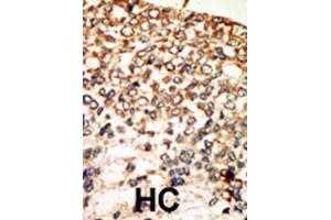 Immunohistochemistry (IHC) image for anti-PKA C-Alpha,PKA C-beta antibody (ABIN3002928) (PKA C-Alpha,PKA C-beta antibody)