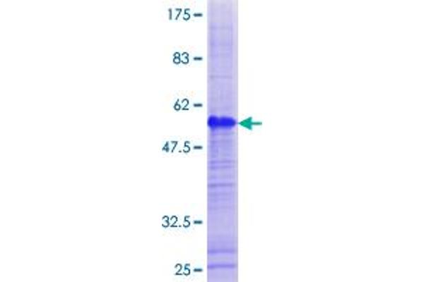 G Antigen 1 Protein (GAGE1) (AA 1-139) (GST tag)