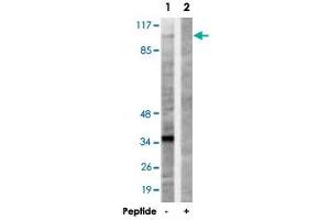 Western blot analysis of extracts from 293 cells, using KIF20A polyclonal antibody . (KIF20A antibody)