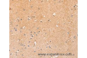 Immunohistochemistry of Human brain  using CCL16  Polyclonal Antibody at dilution of 1:50 (CCL16 antibody)