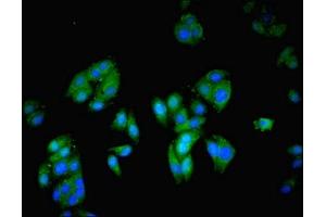 Immunofluorescent analysis of HepG2 cells using ABIN7149353 at dilution of 1:100 and Alexa Fluor 488-congugated AffiniPure Goat Anti-Rabbit IgG(H+L) (NCK2 antibody  (AA 1-380))