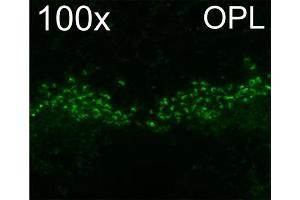 Indirect immunostaining of ribbon synapses in the outer plexiform layer of PFA mouse retina (dilution 1 : 1000). (RIMS2 antibody  (AA 461-987))