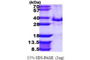 SDS-PAGE (SDS) image for Toll Interacting Protein (TOLLIP) (AA 1-274) protein (His tag) (ABIN667913)