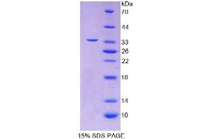 SDS-PAGE analysis of Human TOMM70A Protein. (TOM70 Protein)