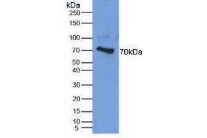 Figure. (Aggrecan antibody  (AA 34-147))