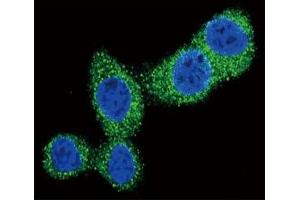 Confocal immunofluorescent analysis of Puma antibody with HeLa cells followed by Alexa Fluor 488-conjugated goat anti-rabbit lgG (green). (PUMA antibody  (AA 119-154))
