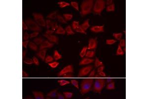 Immunofluorescence analysis of HeLa cells using SEPHS1 Polyclonal Antibody