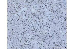 IHC analysis of HMGN2 using anti-HMGN2 antibody (ABIN6719576). (HMGN2 antibody)