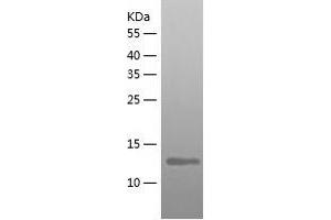 NDFIP1 Protein (AA 1-116) (His tag)