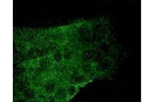 A431 cells were serum starved and treated with EGF (100 ng/ml) for 5 minutes, then fixed in 1:1 methanol-acetone for 10 minutes at -20°C. (STAT3 antibody  (pSer727))