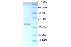 SDS-PAGE (SDS) image for Titin (TTN) (AA 5398-5604), (partial) protein (His tag) (ABIN4976324)