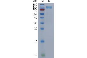 NPR1 Protein (AA 33-473) (Fc Tag)