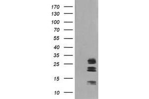 Image no. 1 for anti-Galectin 3 (LGALS3) antibody (ABIN1499247) (Galectin 3 antibody)