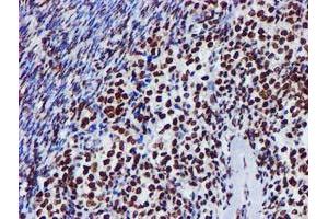 Image no. 2 for anti-Glutathione S-Transferase theta 2 (GSTT2) antibody (ABIN1498553) (GSTT2 antibody)