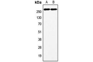 Western blot analysis of Factor VIII expression in HeLa (A), HepG2 (B) whole cell lysates. (Factor VIII antibody  (C-Term))