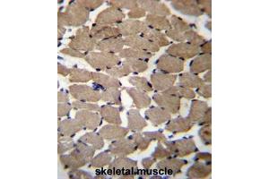 Immunohistochemistry (Paraffin-embedded Sections) (IHC (p)) image for anti-Mannosyl (Alpha-1,3-)-Glycoprotein beta-1,4-N-Acetylglucosaminyltransferase, Isozyme C (MGAT4C) (AA 302-332), (C-Term) antibody (ABIN953409)