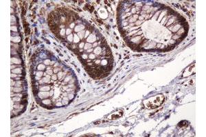 Image no. 6 for anti-B and T Lymphocyte Associated (BTLA) antibody (ABIN1496983)