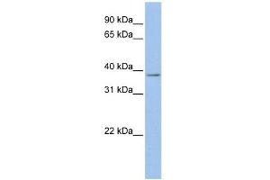 Mesothelin antibody used at 1 ug/ml to detect target protein. (Mesothelin antibody  (Middle Region))