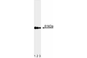 Western blot analysis of calcineurin. (CAN antibody  (AA 349-505))