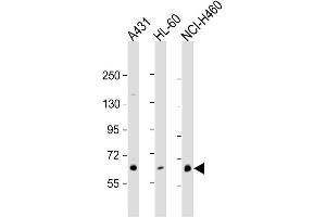 Western Blotting (WB) image for anti-Protein Kinase C, eta (PRKCH) antibody (ABIN3002933) (PKC eta antibody)