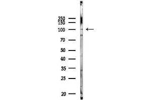 anti-Coiled-Coil Serine-Rich Protein 1 (CCSER1) antibody