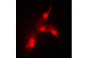 Immunofluorescence (IF) image for anti-Mdm2, p53 E3 Ubiquitin Protein Ligase Homolog (Mouse) (MDM2) (pSer166) antibody (ABIN7299346)