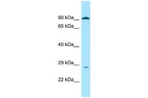 WB Suggested Anti-GLIPR1 Antibody Titration: 1. (GLIPR1 antibody  (Middle Region))