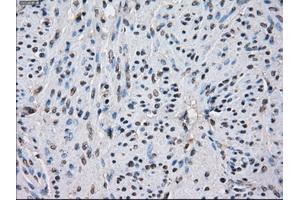 Immunohistochemical staining of paraffin-embedded colon tissue using anti-IDH1 mouse monoclonal antibody. (IDH1 antibody)