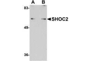Western Blotting (WB) image for anti-Leucine-rich repeat protein SHOC-2 (SHOC2) (N-Term) antibody (ABIN1031560) (SHoc2/Sur8 antibody  (N-Term))