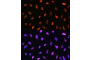 Immunofluorescence analysis of U2OS cells using DDIT3/CHOP antibody (ABIN3020709, ABIN3020710, ABIN3020711, ABIN1512759 and ABIN6213685) at dilution of 1:100. (DDIT3 antibody  (C-Term))