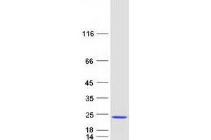 Validation with Western Blot (CPLX2 Protein (Transcript Variant 2) (Myc-DYKDDDDK Tag))