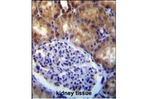 MLLT7 antibody (N-term) (ABIN390133 and ABIN2840637) immunohistochemistry analysis in formalin fixed and paraffin embedded human kidney tissue followed by peroxidase conjugation of the secondary antibody and DAB staining. (FOXO4 antibody  (N-Term))