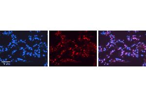 NR2F6 antibody - N-terminal region          Formalin Fixed Paraffin Embedded Tissue:  Human Lung Tissue    Observed Staining:  Nucleus of pneumocytes   Primary Antibody Concentration:  1:100    Other Working Concentrations:  1/600    Secondary Antibody:  Donkey anti-Rabbit-Cy3    Secondary Antibody Concentration:  1:200    Magnification:  20X    Exposure Time:  0. (NR2F6 antibody  (N-Term))