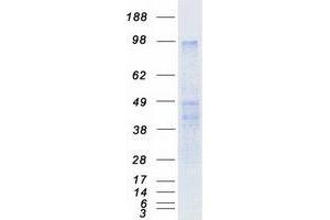 Validation with Western Blot