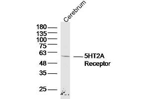 Mouse cerebrum lysates probed with 5HT2A Receptor Polyclonal Antibody, Unconjugated  at 1:300 dilution and 4˚C overnight incubation. (HTR2A antibody  (AA 171-270))