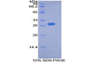 SDS-PAGE (SDS) image for Pyruvate Dehydrogenase Kinase, Isozyme 2 (PDK2) (AA 155-379) protein (His tag) (ABIN2126590)