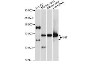 Western blot analysis of extracts of various cell lines, using NNT antibody (ABIN5972604) at 1:3000 dilution. (NNT antibody)