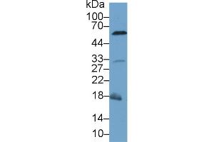 Western blot analysis of Mouse Liver lysate, using Mouse CASP8 Antibody (1 µg/ml) and HRP-conjugated Goat Anti-Rabbit antibody ( (Caspase 8 antibody  (AA 1-218))