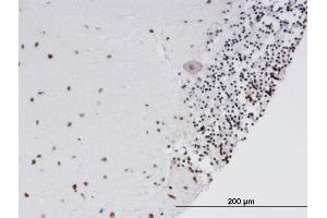 Immunoperoxidase of monoclonal antibody to SOX15 on formalin-fixed paraffin-embedded human cerebellum. (SOX15 antibody  (AA 1-233))